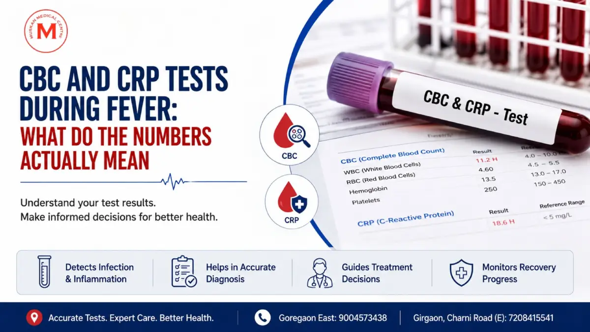 CBC test in Girgaon Mumbai